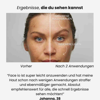 GlowLift One™ – Dein Multitalent für strahlende Haut glätten, straffen, reinigen