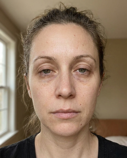 Probiotic Lift & Glow Eye Stick