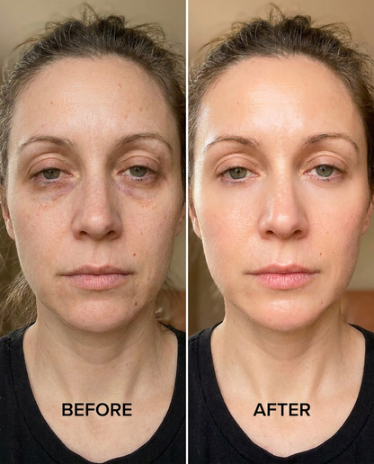 Probiotic Lift & Glow Eye Stick